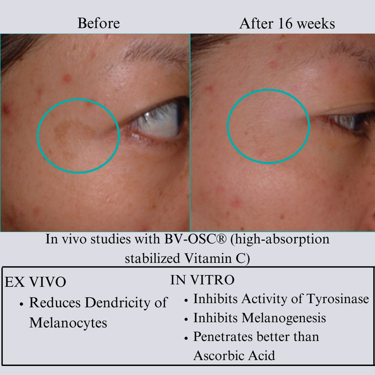 Hyaluron 3D Hydrator Multi Lamellar Emulsion The Advanced Response Face and Neck Cream-Serum