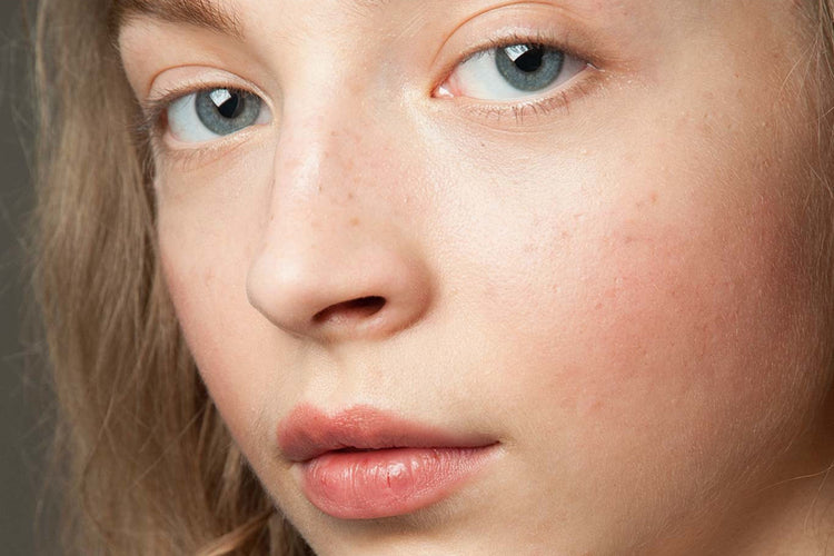Sensitive + Redness Relief