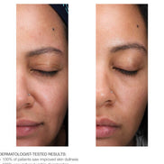 Lactic Acid Micro-Peel | Retexturing & Hydrating Chemical Exfoliant