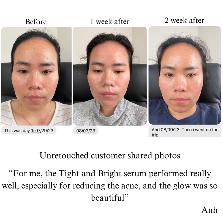 TIGHT AND BRIGHT, an Advanced Gentle Phyto-Retinol and Vitamin C Face Serum, 12 Innovative Technologies, 55% High-Performance Cosmeceuticals