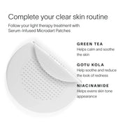 Bye Acne: 3-Minute Pimple Spot Treatment