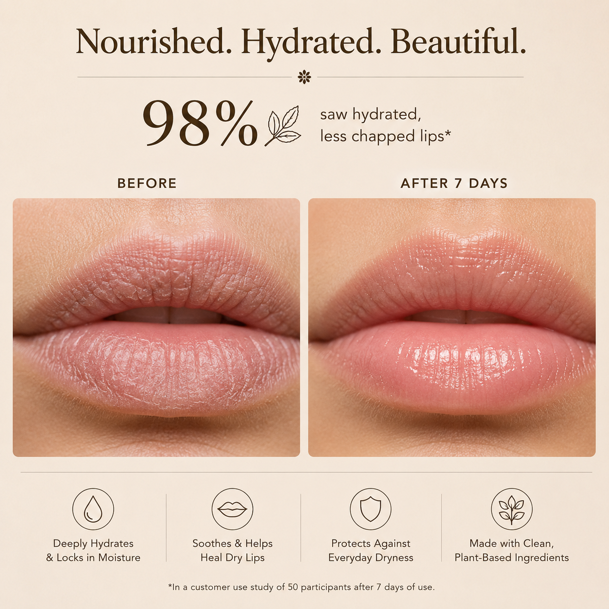 Protector Labial