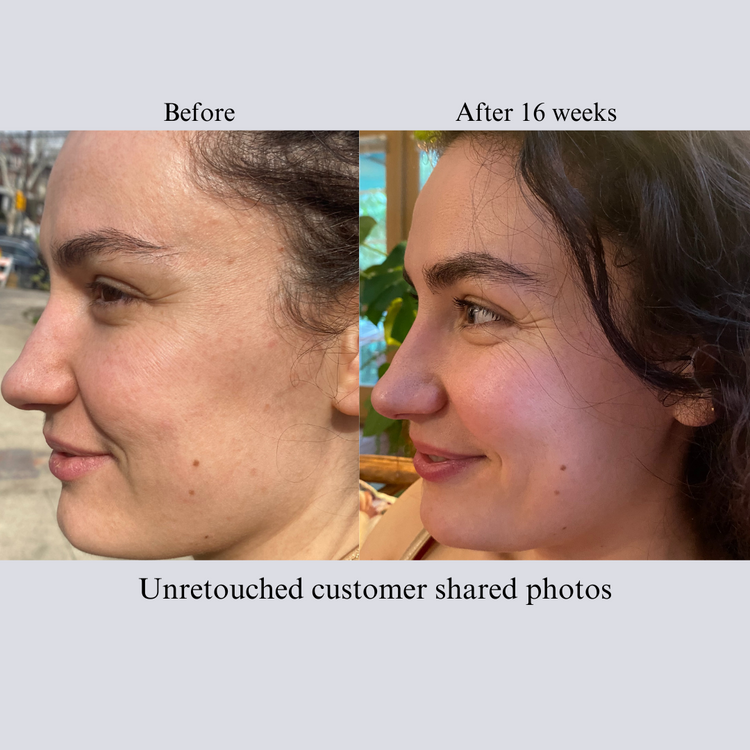 TIGHT AND BRIGHT, an Advanced Gentle Phyto-Retinol and Vitamin C Face Serum, 12 Innovative Technologies, 55% High-Performance Cosmeceuticals