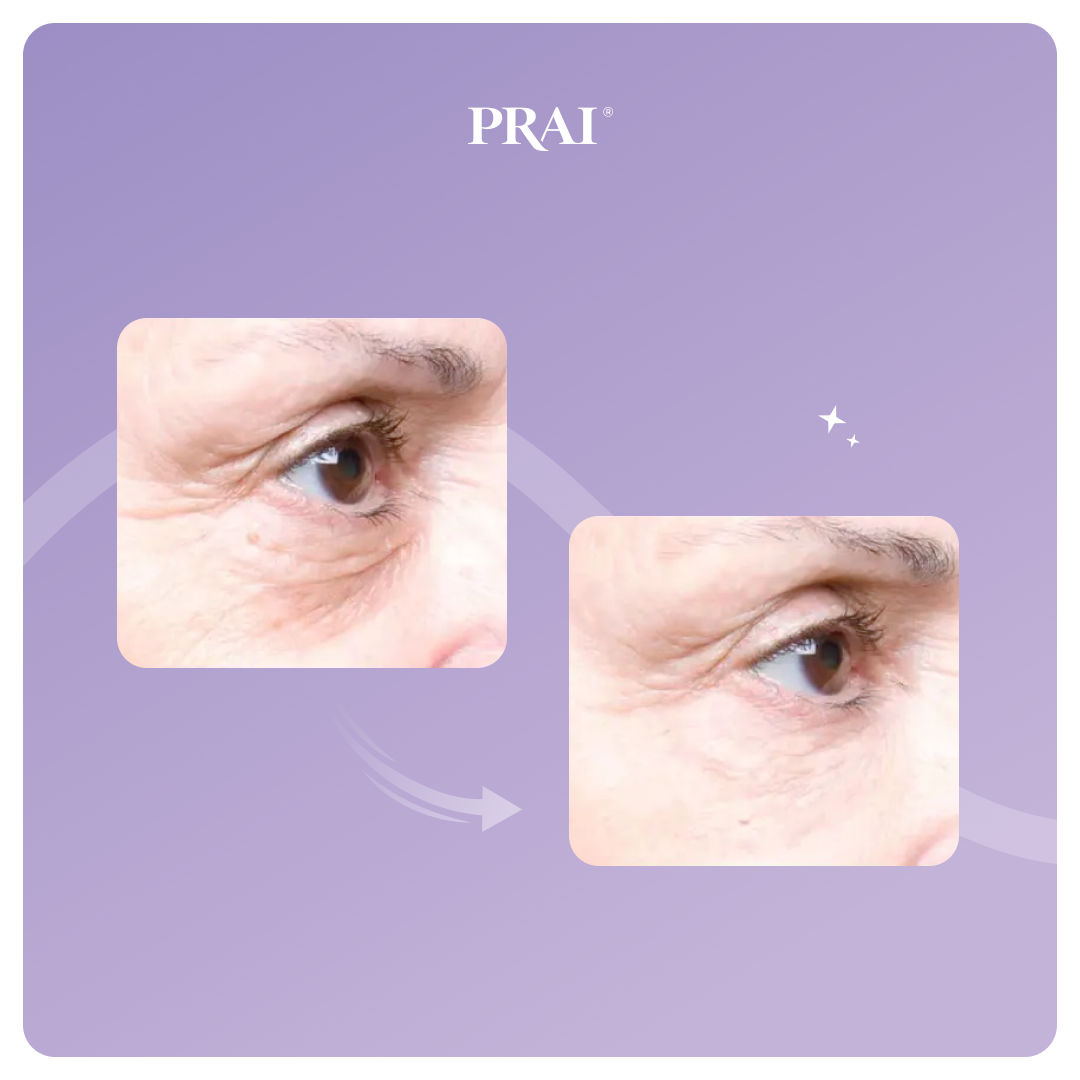 Sérum Reafirmante y Lifting para Contorno de Ojos de Efecto Duradero