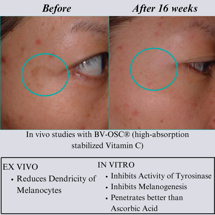 NILCEUTICA Bestsellers Discovery and Travel kit