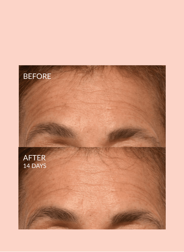 Triple Lift Molecule Mask